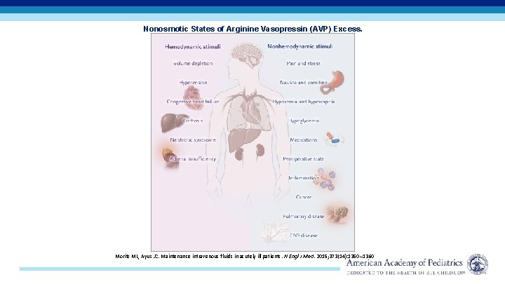 Nonosmotic States of Arginine Vasopressin (AVP) Excess. Moritz ML, Ayus JC. Maintenance intravenous fluids