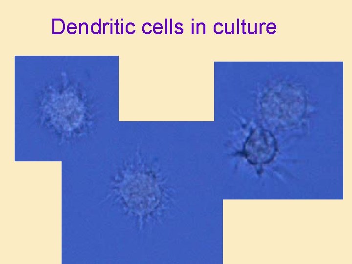 Dendritic cells in culture Dendritic cells in culture
