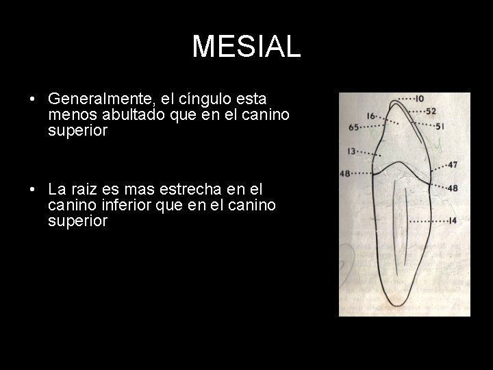 MESIAL • Generalmente, el cíngulo esta menos abultado que en el canino superior •