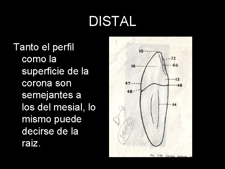 DISTAL Tanto el perfil como la superficie de la corona son semejantes a los