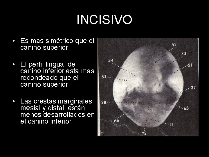 INCISIVO • Es mas simétrico que el canino superior • El perfil lingual del