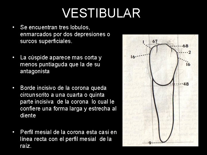 VESTIBULAR • Se encuentran tres lobulos, enmarcados por dos depresiones o surcos superficiales. •