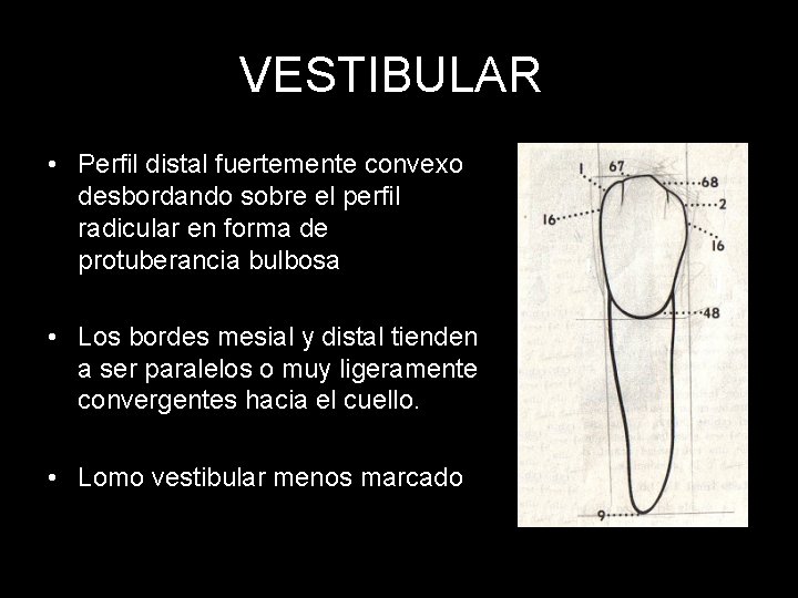 VESTIBULAR • Perfil distal fuertemente convexo desbordando sobre el perfil radicular en forma de