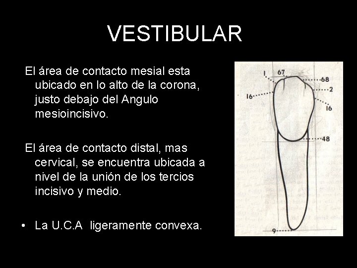 VESTIBULAR El área de contacto mesial esta ubicado en lo alto de la corona,