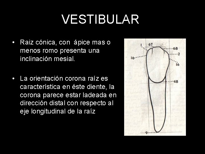 VESTIBULAR • Raiz cónica, con ápice mas o menos romo presenta una inclinación mesial.