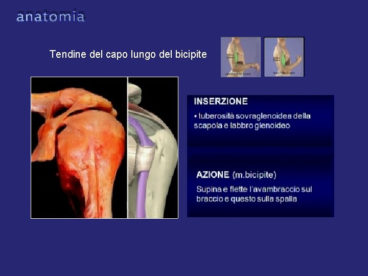 anatomia Tendine del capo lungo del bicipite anatomia Tendine del capo lungo del bicipite