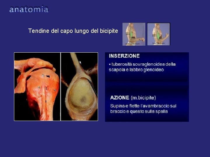 anatomia Tendine del capo lungo del bicipite anatomia Tendine del capo lungo del bicipite