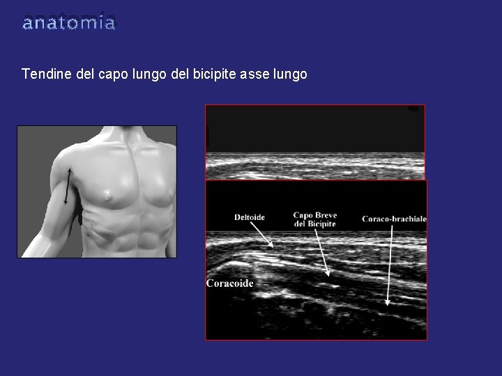 anatomia Tendine del capo lungo del bicipite asse lungo anatomia Tendine del capo lungo del bicipite asse lungo
