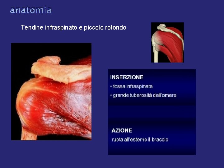 anatomia Tendine infraspinato e piccolo rotondo anatomia Tendine infraspinato e piccolo rotondo