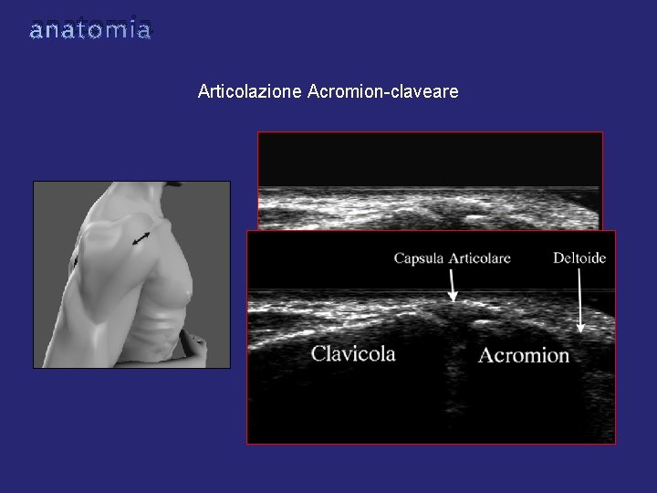 anatomia Articolazione Acromion-claveare anatomia Articolazione Acromion-claveare