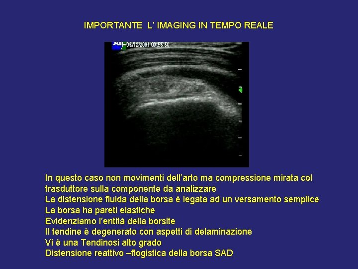IMPORTANTE L’ IMAGING IN TEMPO REALE In questo caso non movimenti dell’arto ma compressione IMPORTANTE L’ IMAGING IN TEMPO REALE In questo caso non movimenti dell’arto ma compressione
