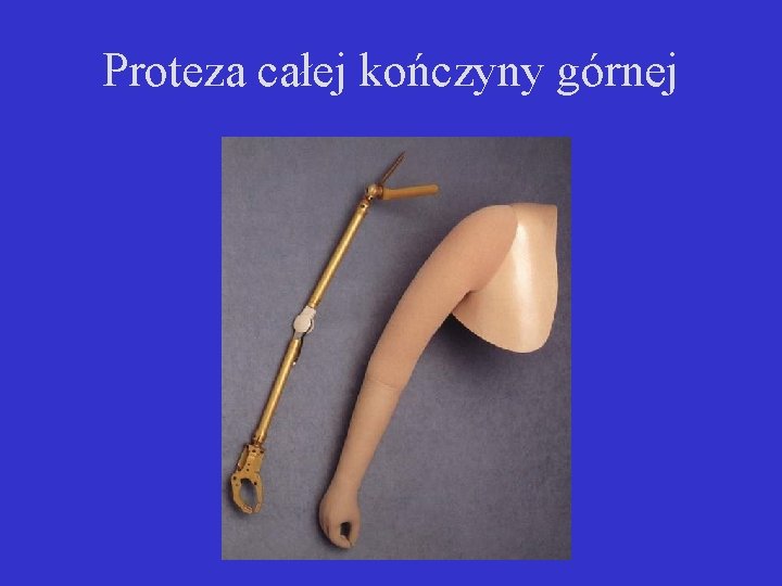 Proteza całej kończyny górnej 