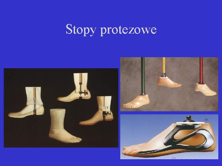 Stopy protezowe 