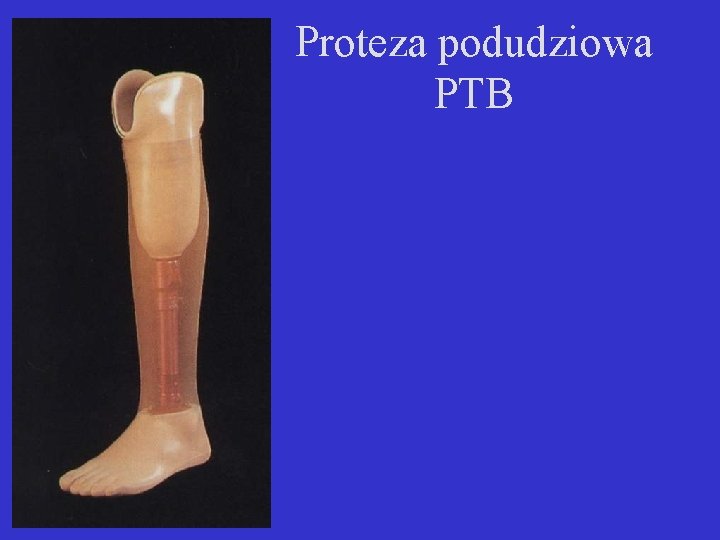 Proteza podudziowa PTB 