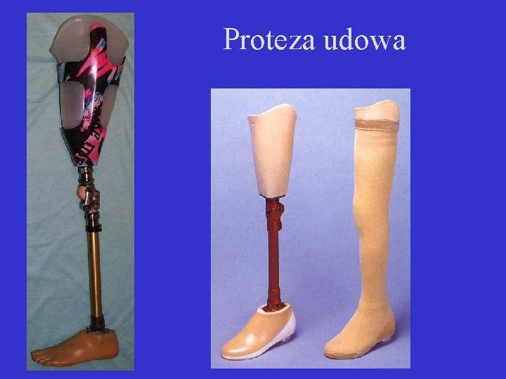 Proteza udowa 