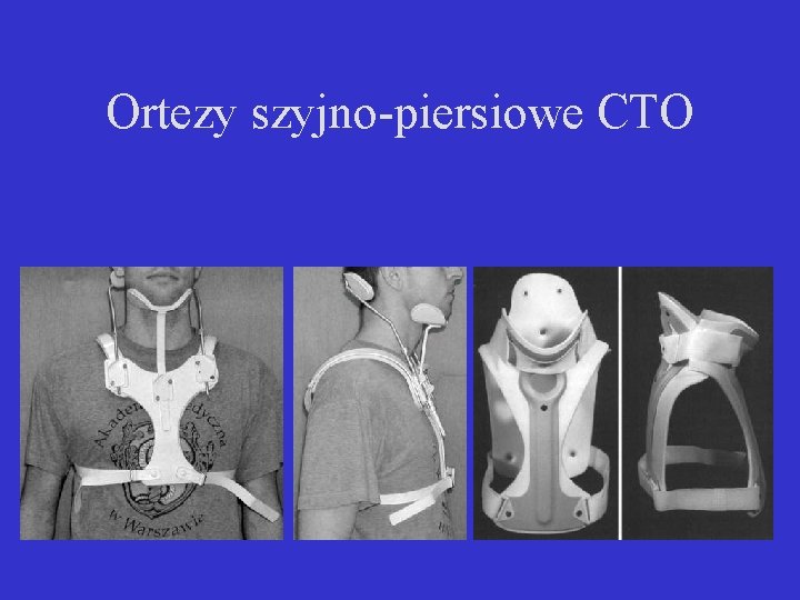 Ortezy szyjno-piersiowe CTO 