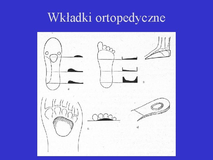 Wkładki ortopedyczne 