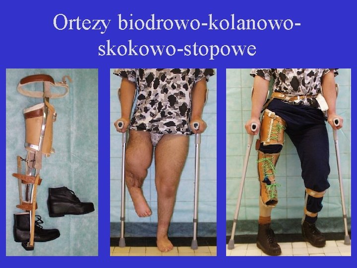 Ortezy biodrowo-kolanowoskokowo-stopowe 