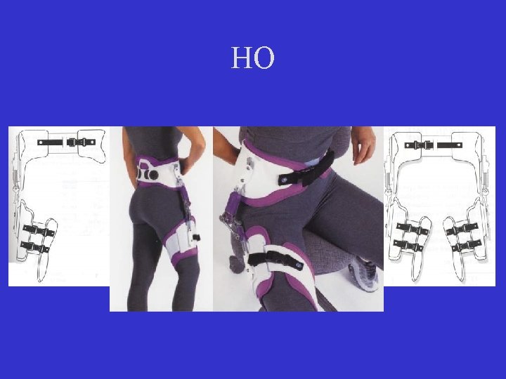 HO 