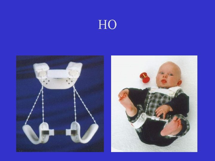 HO 