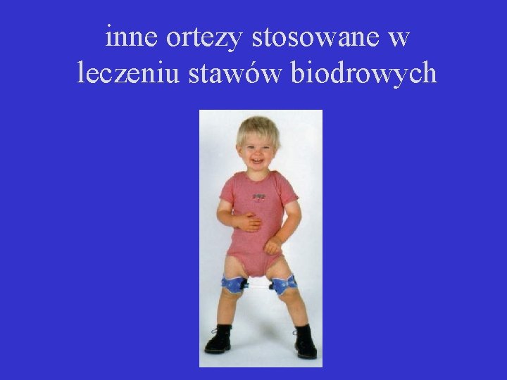 inne ortezy stosowane w leczeniu stawów biodrowych 