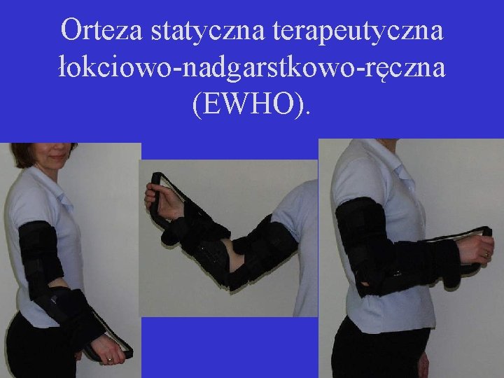 Orteza statyczna terapeutyczna łokciowo-nadgarstkowo-ręczna (EWHO). 