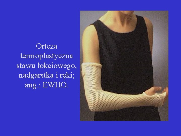 Orteza termoplastyczna stawu łokciowego, nadgarstka i ręki; ang. : EWHO. 