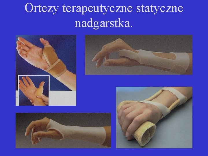 Ortezy terapeutyczne statyczne nadgarstka. 