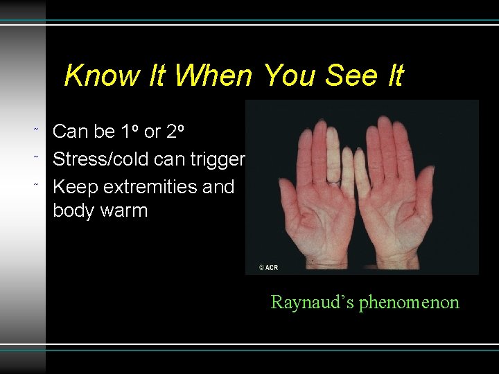 Know It When You See It ˜ ˜ ˜ Can be 1 o or