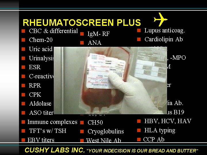 RHEUMATOSCREEN PLUS n CBC & differential n Ig. M- RF n Chem-20 n ANA