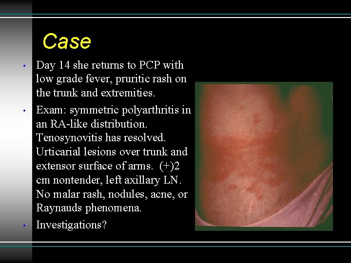 Case • • • Day 14 she returns to PCP with low grade fever,