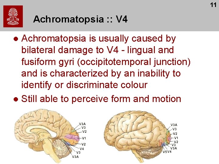 11 Achromatopsia : : V 4 Achromatopsia is usually caused by bilateral damage to