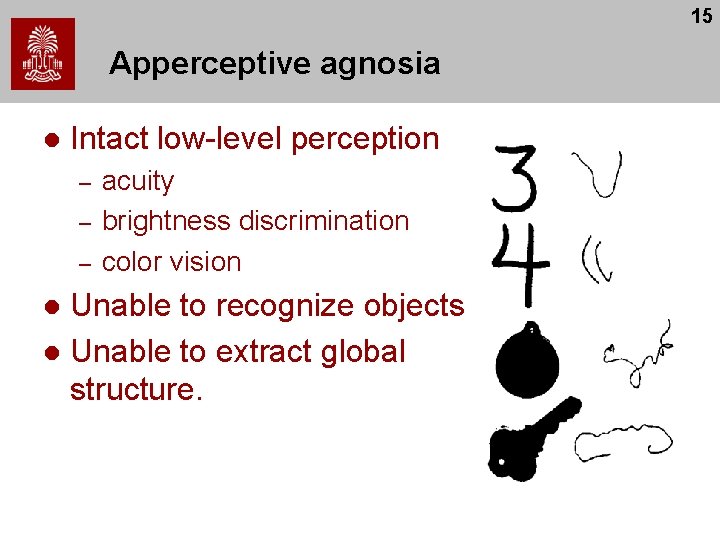 15 Apperceptive agnosia l Intact low-level perception – – – acuity brightness discrimination color