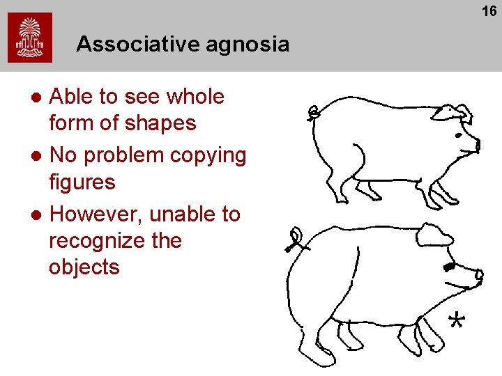 16 Associative agnosia Able to see whole form of shapes l No problem copying