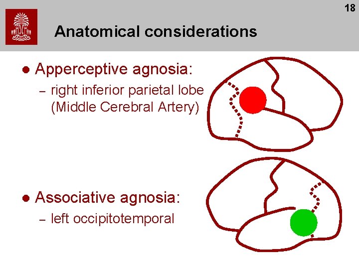 18 Anatomical considerations l Apperceptive agnosia: – l right inferior parietal lobe (Middle Cerebral