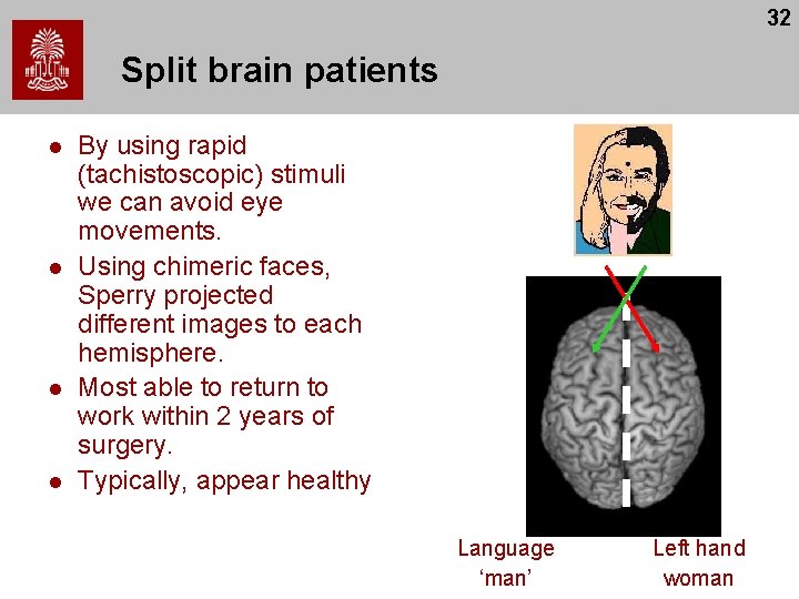 32 Split brain patients l l By using rapid (tachistoscopic) stimuli we can avoid