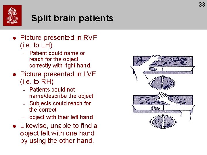 33 Split brain patients l Picture presented in RVF (i. e. to LH) –