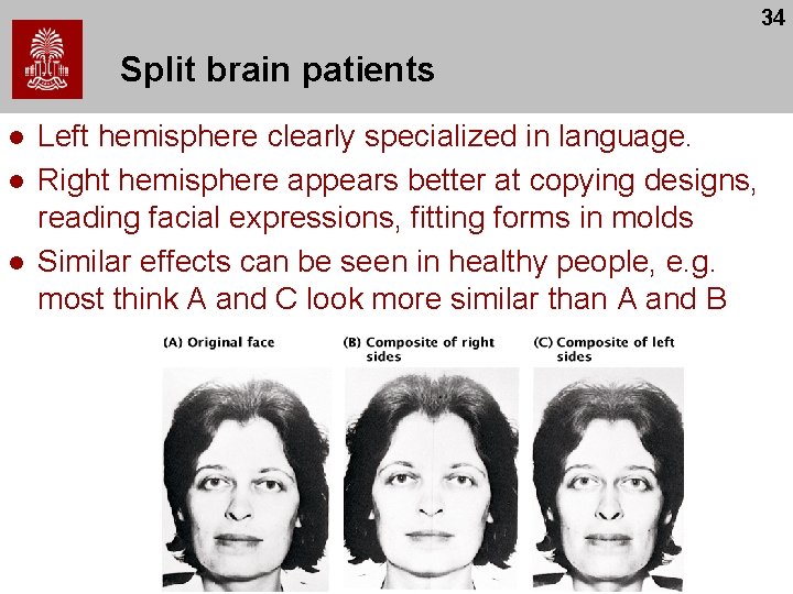 34 Split brain patients l l l Left hemisphere clearly specialized in language. Right