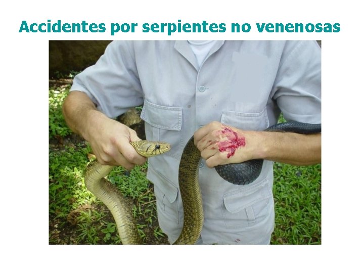 Accidentes por serpientes no venenosas 