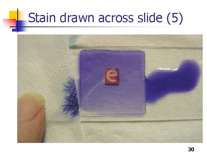 Stain drawn across slide (5) 30 