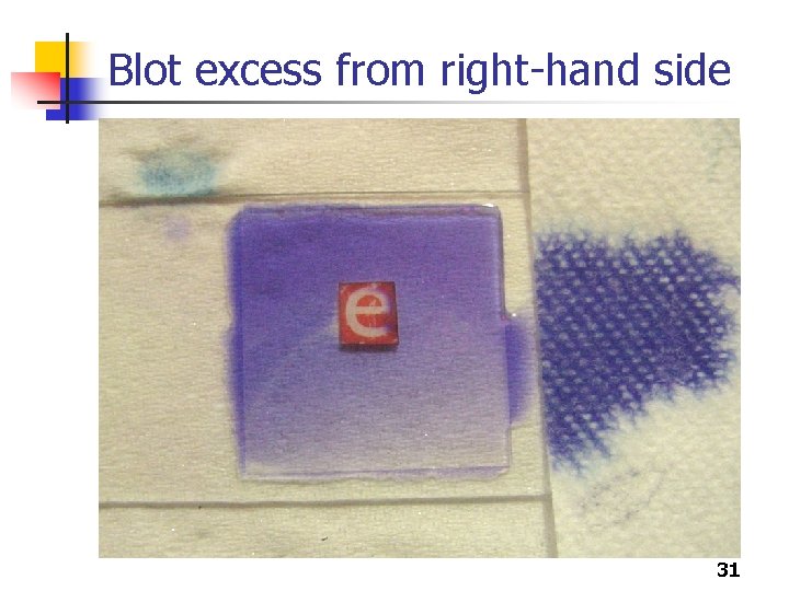 Blot excess from right-hand side 31 