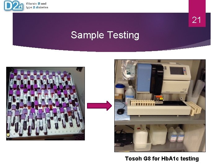 21 Sample Testing Tosoh G 8 for Hb. A 1 c testing 21 Sample Testing Tosoh G 8 for Hb. A 1 c testing