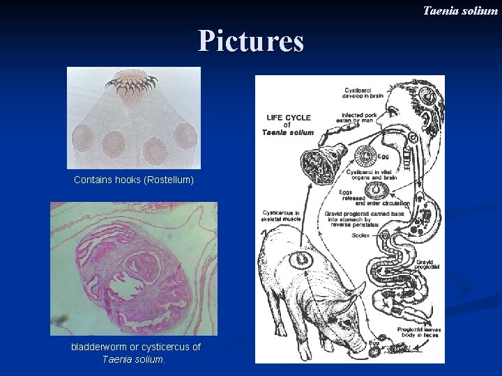 Taenia solium Pictures Contains hooks (Rostellum) bladderworm or cysticercus of Taenia solium. 