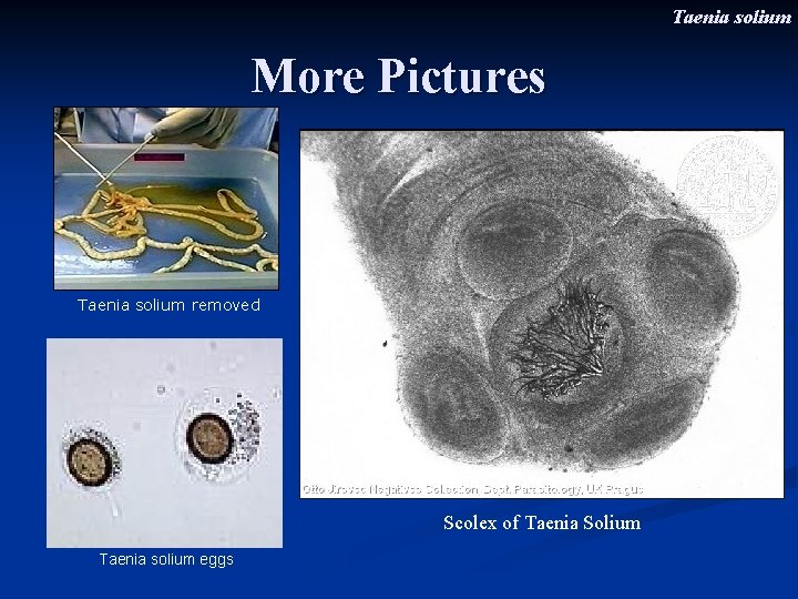 Taenia solium More Pictures Taenia solium removed Scolex of Taenia Solium Taenia solium eggs