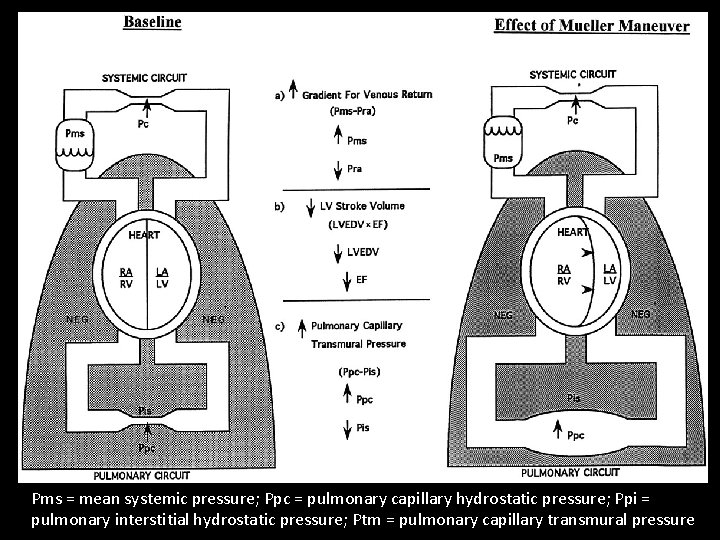 Pms = mean systemic pressure; Ppc = pulmonary capillary hydrostatic pressure; Ppi = pulmonary