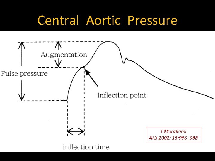 Central Aortic Pressure T Murakami AHJ 2002; 15: 986– 988 