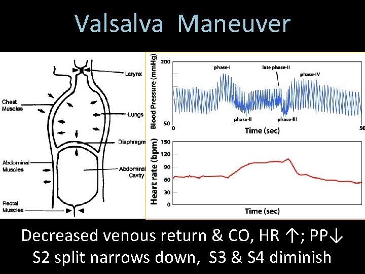 Valsalva Maneuver Decreased venous return & CO, HR ↑; PP↓ S 2 split narrows