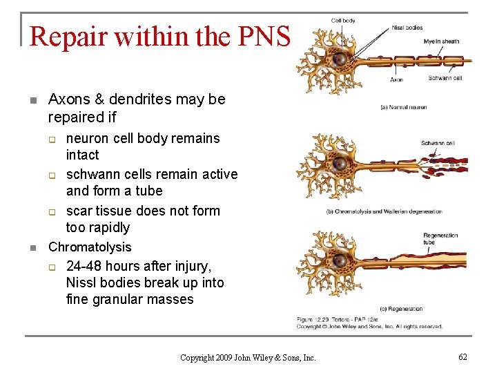 Repair within the PNS n Axons & dendrites may be repaired if q q