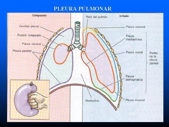 PLEURA PULMONAR 