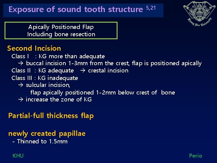 Exposure of sound tooth structure 5, 21 Apically Positioned Flap Including bone resection Second